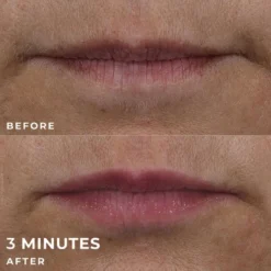 RoC Derm Correxion Lip Volumizer Treatment - 0.34 Fl Oz -Glow Up Beauty Store GUEST 046de80e e2e1 4ca2 b5df eed1352c61b0