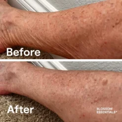 Blossom Essentials Hydration Repair Honey Salve 20 Blossom Essentials Hydration Repair Honey Salve -Glow Up Beauty Store GUEST 084f9ecf 7408 446a 8fc0 f5fb0a95456c