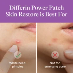 Differin Skin Restore Power Patches - 23ct -Glow Up Beauty Store GUEST 1e888f95 4eba 4ab8 967e e65928ff32be
