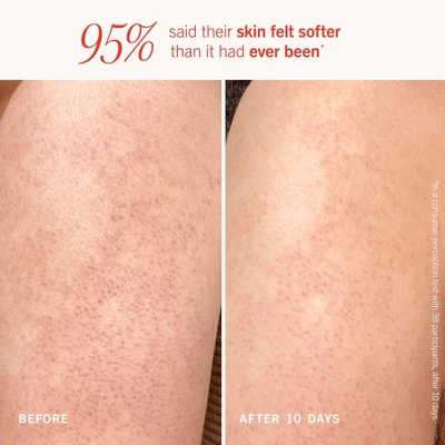 FIRST AID BEAUTY Women's KP Bump Eraser Body Scrub With 10% AHA Travel Size Set - 2ct - Ulta Beauty 7 FIRST AID BEAUTY Women's KP Bump Eraser Body Scrub With 10% AHA Travel Size Set - 2ct - Ulta Beauty - Image 5