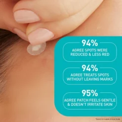 CeraVe Acne Control Patches - 22ct -Glow Up Beauty Store GUEST 49c41799 a1fa 4ea1 987c 5df66e87f8fc