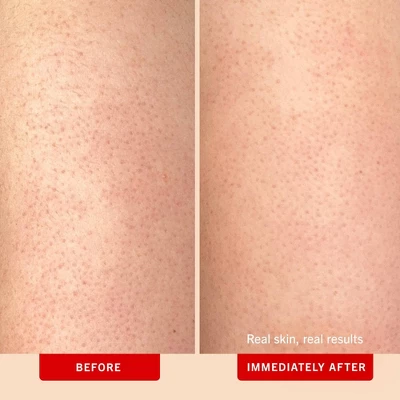 FIRST AID BEAUTY KP Bump Eraser Exfoliating Body Scrub For Sensitive To Normal Skin - Peach - 8oz - Ulta Beauty 4 FIRST AID BEAUTY KP Bump Eraser Exfoliating Body Scrub For Sensitive To Normal Skin - Peach - 8oz - Ulta Beauty - Image 2