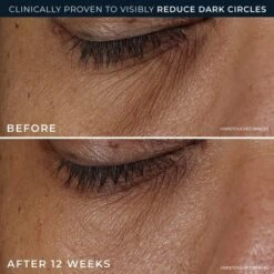 RoC Derm Correxion Dark Circle Eye Repair Cream - 15ml -Glow Up Beauty Store GUEST 50229e38 8cfd 42fc a091 07887d793b43