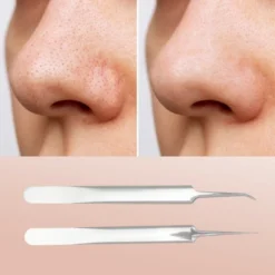Unique Bargains Facial Pimple Extractor Tool Kit 1 Set -Glow Up Beauty Store GUEST 52daa498 963e 41af 821a e663736a3511