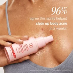 FIRST AID BEAUTY Body Acne Clearing Mist With 2% Salicylic Acid - 3oz - Ulta Beauty 16 FIRST AID BEAUTY Body Acne Clearing Mist With 2% Salicylic Acid - 3oz - Ulta Beauty -Glow Up Beauty Store GUEST 56441a8e 4aa3 4e4c a70c 8a10a3ed46cd