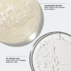 Clinique Acne Solutions Clinical Advanced Clearing Gel - 0.34 Fl Oz - Ulta Beauty -Glow Up Beauty Store GUEST 5d1e5ee2 0511 4921 a2fa 0168d38ce9aa