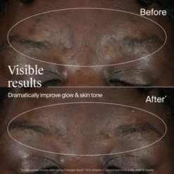 Neutrogena Collagen Bank 15% Vitamin C Glow + Tone Booster Serum - 0.5 Fl Oz 17 Neutrogena Collagen Bank 15% Vitamin C Glow + Tone Booster Serum - 0.5 Fl Oz -Glow Up Beauty Store GUEST 909b0f28 dc4c 4ae8 93d7 3863e0488736