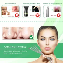 5PCS Blackhead Remover Set – Curved Tweezers & Comedone Extractor Tools Kit For Acne & Pimple Removal