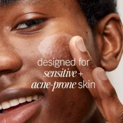 FIRST AID BEAUTY Daily Resurfacing Moisturizer With 2% Niacinamide - 1 Fl Oz - Ulta Beauty -Glow Up Beauty Store GUEST 9afffc30 74e8 46c3 9755 20e213df69b7