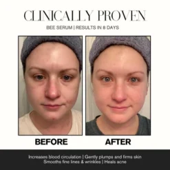 Intoxicated Cosmetics Bee Serum Anti-Aging & Clarifying 1oz | 30mL -Glow Up Beauty Store GUEST a9409148 35d5 4973 a603 a10ade8bb998