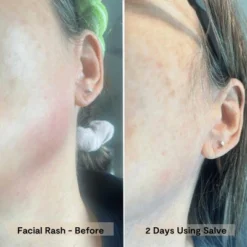 Blossom Essentials Hydration Repair Honey Salve 23 Blossom Essentials Hydration Repair Honey Salve -Glow Up Beauty Store GUEST abf78abf 8146 4167 a6b8 a7534ea54c15