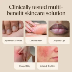 Aveeno Skin Relief Healing Ointment, Repair + Protect - 2oz -Glow Up Beauty Store GUEST df473429 9840 43cb a901 46ef3072cf43