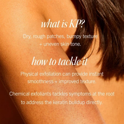 FIRST AID BEAUTY KP Bump Eraser Exfoliating Body Scrub For Sensitive To Normal Skin - Peach - 8oz - Ulta Beauty 5 FIRST AID BEAUTY KP Bump Eraser Exfoliating Body Scrub For Sensitive To Normal Skin - Peach - 8oz - Ulta Beauty - Image 3